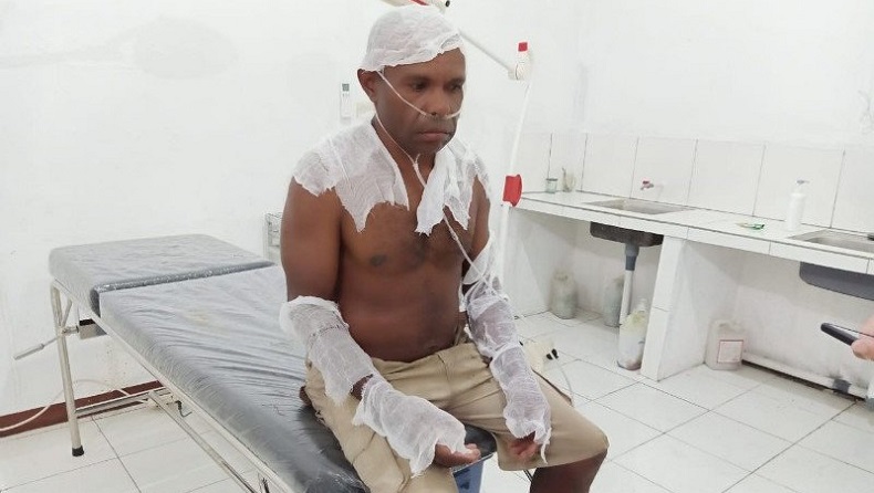 Gereja di Dekai Yakuhimo Terbakar, Seorang Pendeta Luka-Luka