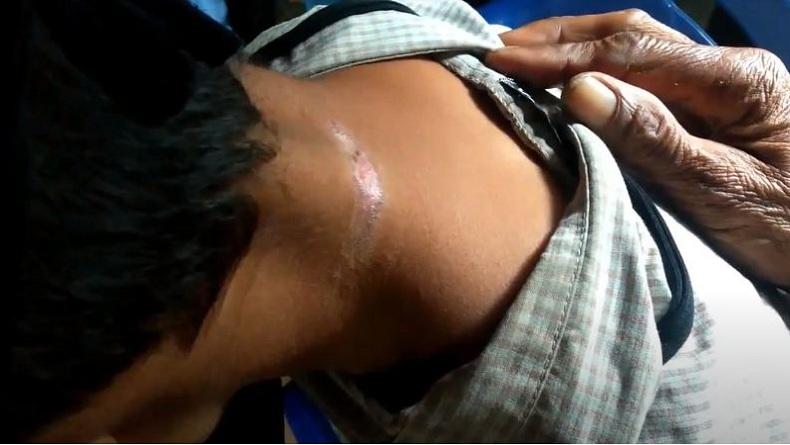 Dituduh Curi HP, Remaja 14 Tahun di Asahan Diisi dalam Karung Goni dan Disiksa