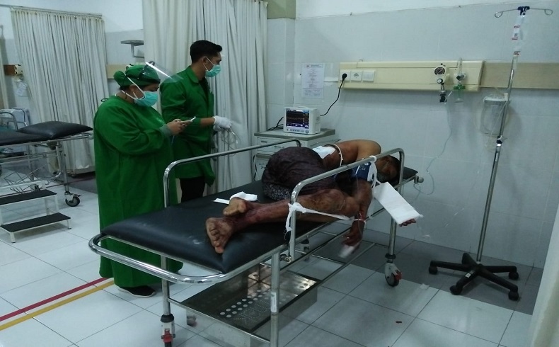 Suami di Prabumulih Sekarat Usai Disayat Cutter Istri Siri