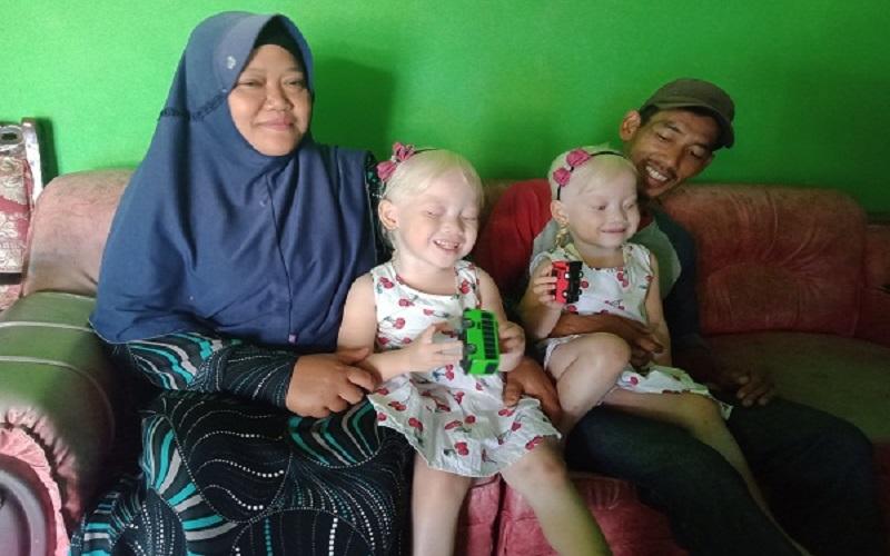 Anak Kembar Albino di Wonogiri Viral, Orang Tua Sempat Dikira Pembantu