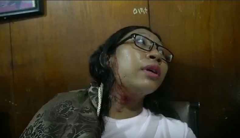 Anak Rebutan Layangan, Orang Tua di Pontianak Cekcok hingga Kepala Bocor