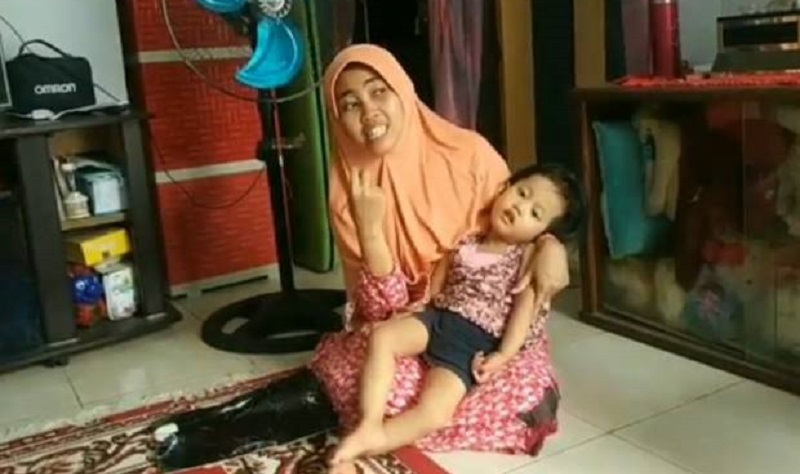 Idap Penyakit Langka, Balita di Pasuruan Tidak Bisa Bergerak Bahkan Tertawa