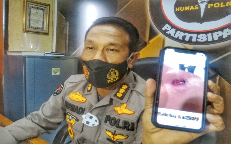 Mahasiswa di Palembang Korban Peluru Nyasar, Polda Sumsel: Lecet Kena Rekoset