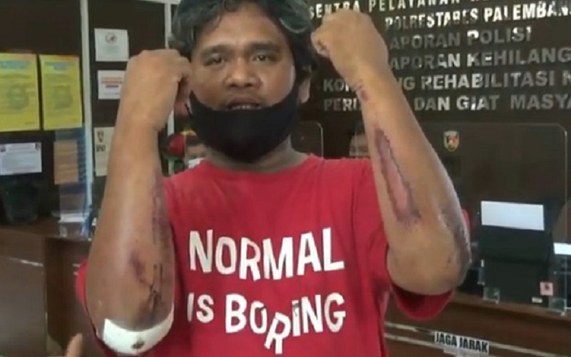 Korban Mata Elang, Wartawan di Palembang Ditabrak dan Terseret hingga 10 Meter 