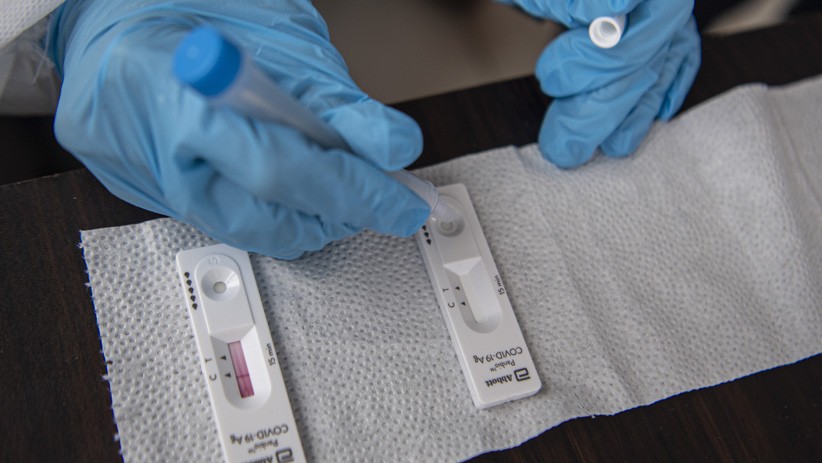 Kasus Antigen Bekas, Kimia Farma Pecat Petugas Layanan Rapid Test Kualanamu