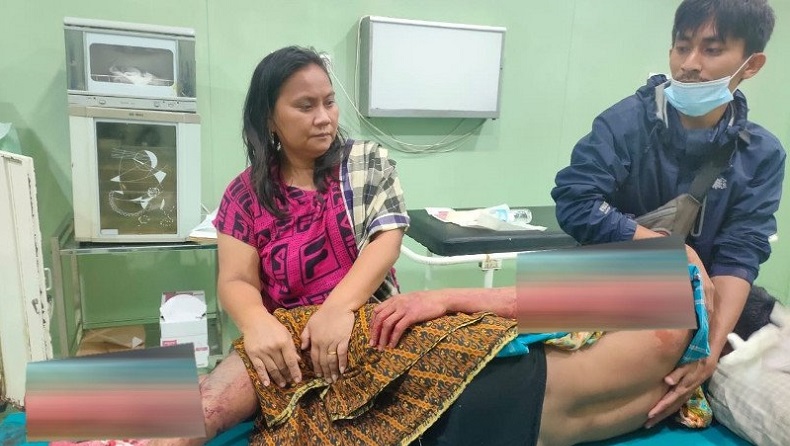 Teriak saat Pergoki 2 Perampok Kios, Warga Jayawijaya Ditusuk Berkali-Kali