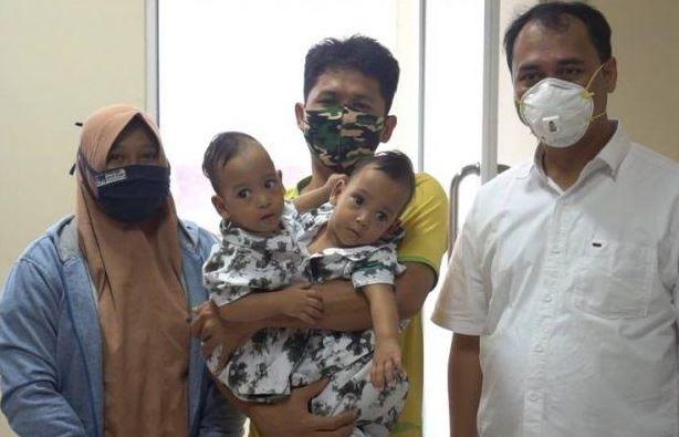 Dioperasi 10 Jam, Kembar Siam Adam-Haris Dipisahkan Dokter RSUP Adam Malik