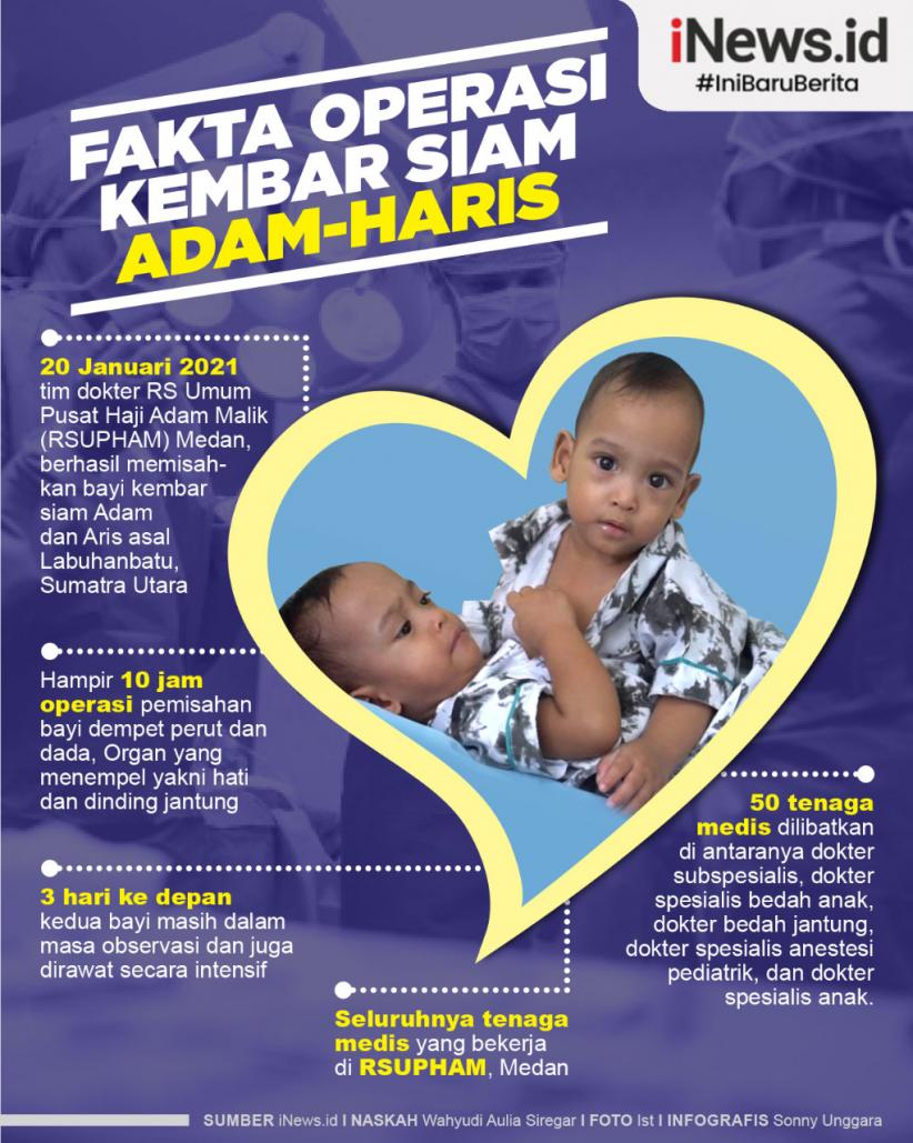 Infografis Operasi Kembar Siam Adam-Haris