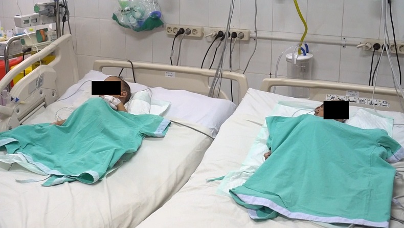 12 Hari Pascaoperasi Pemisahan, Kondisi Bayi Kembar Siam Dempet Dada di Medan Membaik