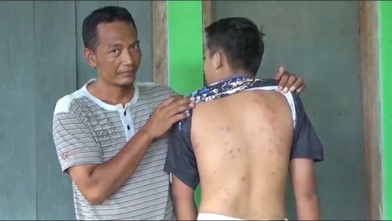 Tebang Bambu, Bapak Anak Diserang Tawon Vespa 