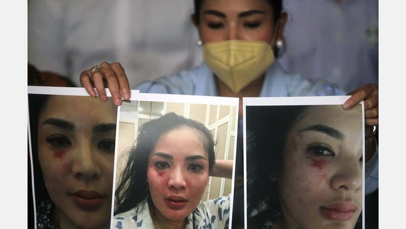 Ini Wajah Lebam Nindy Ayunda akibat KDRT, Ditunjukkan kepada Komnas Perempuan - Bagian 1