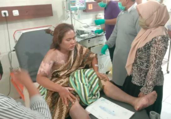 Tragis, Anak Tewas Dibakar Ibu yang Nekat Bakar Diri Gegara TV Rusak