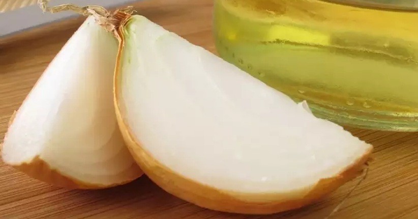 Jus Bawang hingga Minyak Kelapa Bisa Tumbuhkan Rambut, Ini Caranya