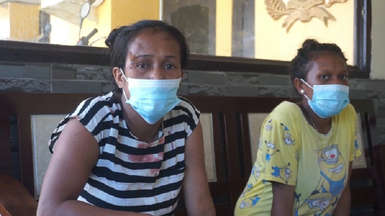 Ibu Rumah Tangga di Mimika Babak Belur Dipukul Adik Kandung yang Mabuk