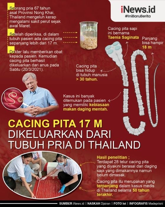 Infografis Cacing Pita 17 Meter Dikeluarkan dari Anus Pria di Thailand