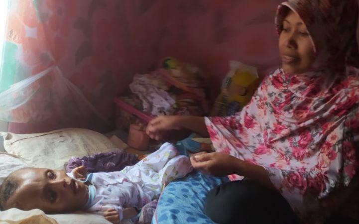 Tolong, Bocah 9 Tahun Penderita Hydrocephalus di Banjarnegara Butuh Bantuan