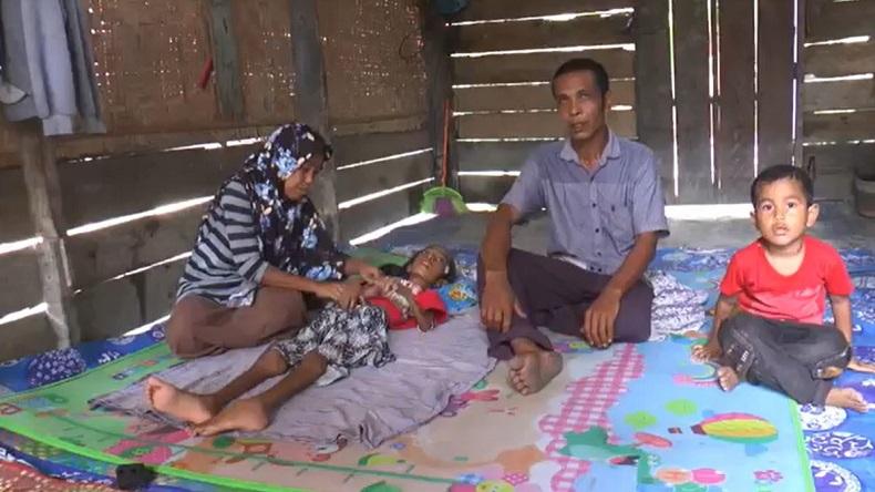 Orang Tua Tak Ada Biaya Berobat, Anak 11 Tahun Sakit Komplikasi Dirawat di Rumah