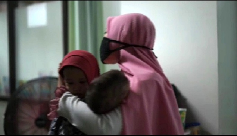 RSHS Bandung Berhasil Pisahkan Bayi Kembar Siam Hasna dan Husna