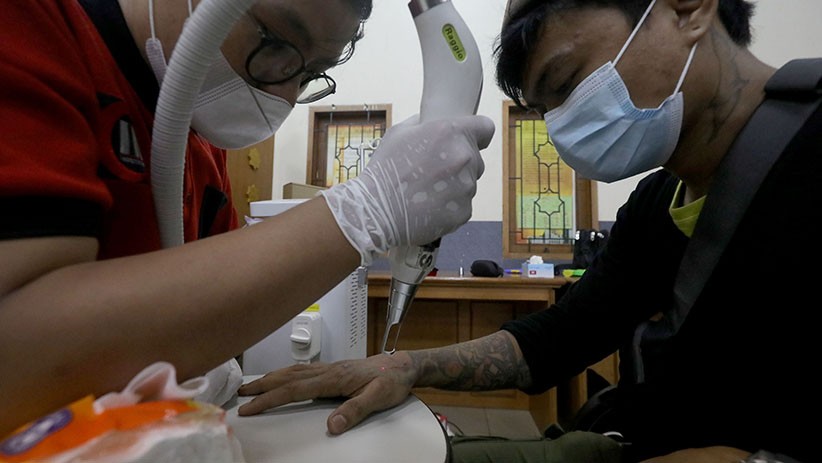 Layanan Hapus Tato Gratis di Jakarta Islamic Center - Bagian 1
