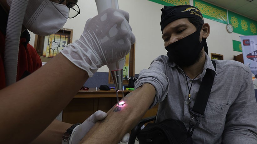 Layanan Hapus Tato Gratis di Jakarta Islamic Center - Bagian 2