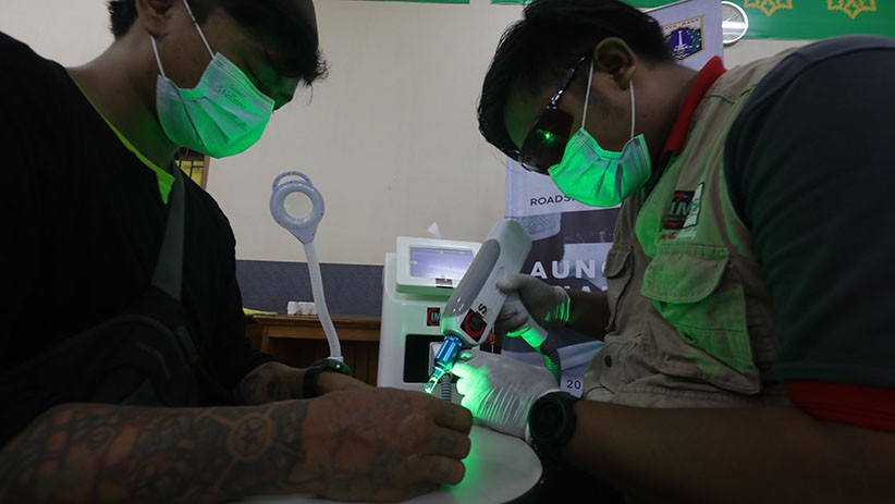 Layanan Hapus Tato Gratis di Jakarta Islamic Center - Bagian 3