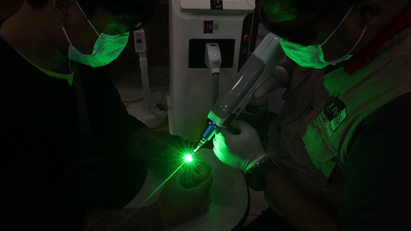 Layanan Hapus Tato Gratis di Jakarta Islamic Center - Bagian 4