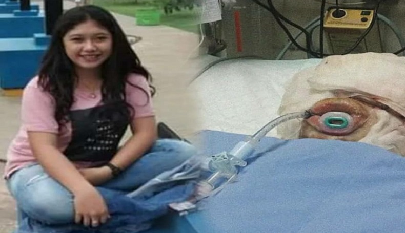 Viral Foto Cantik Indah Sebelum Dibakar Pacar, Netizen di Cianjur Heboh 