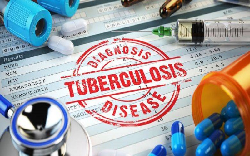 Pemkot Jogja Prioritaskan Pemeriksaan TBC bagi ODHA