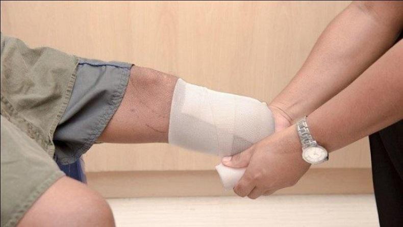  Serem, Dokter Ini Salah Amputasi Kaki Pasien