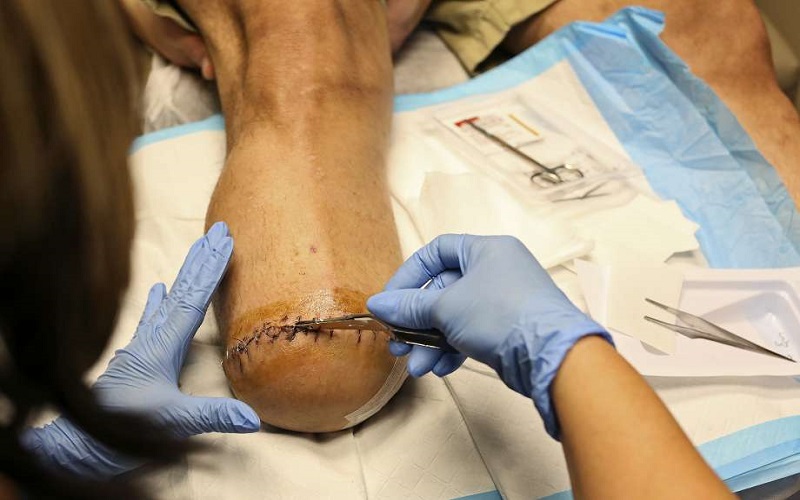 Doktor didenda RM12,000 kerana tersalah potong kaki pesakit