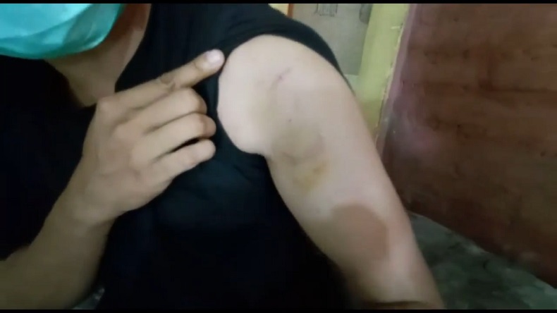 Tenaga Honorer Satgas Covid-19 di RSUD Lebak Sering Dianiaya Istri, Anaknya Diancam Sajam