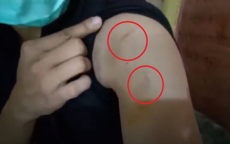 Viral Mama Muda Bertato Aniaya Bayi, Suami Mengaku Sering Digigit saat Bertengkar