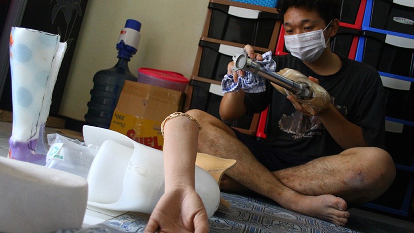 Perajin Kaki Palsu Kekurangan Tenaga Kerja Terampil - Bagian 3