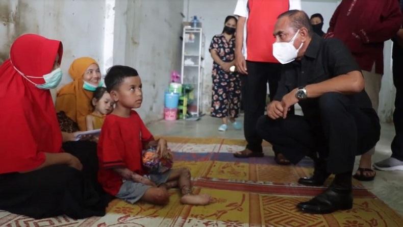 2 Bocah asal Madina Penderita Penyakit Kulit Diobservasi di RS Haji Medan