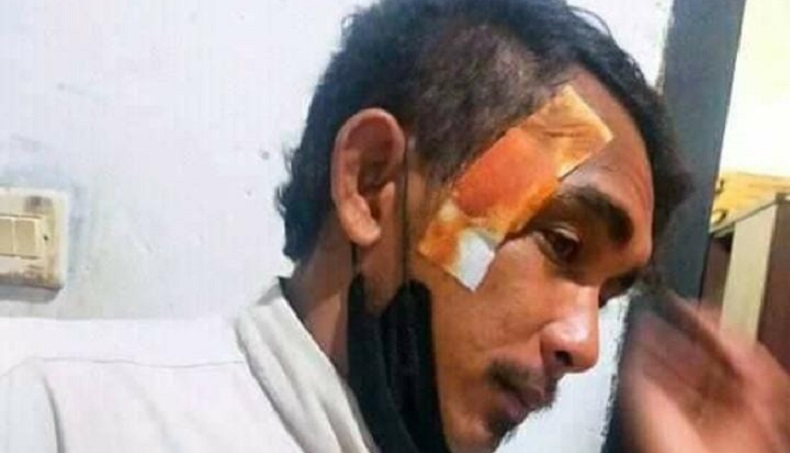 Sidang Kasus Dugaan Korupsi Wawali Bima, 2 Saksi Diancam OTK 
