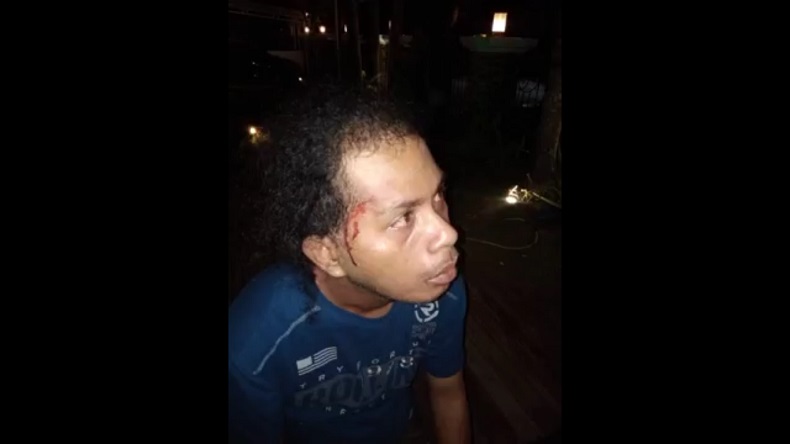 Oknum Anggota Polres Tual Dituduh Aniaya Orang dengan Gangguan Jiwa