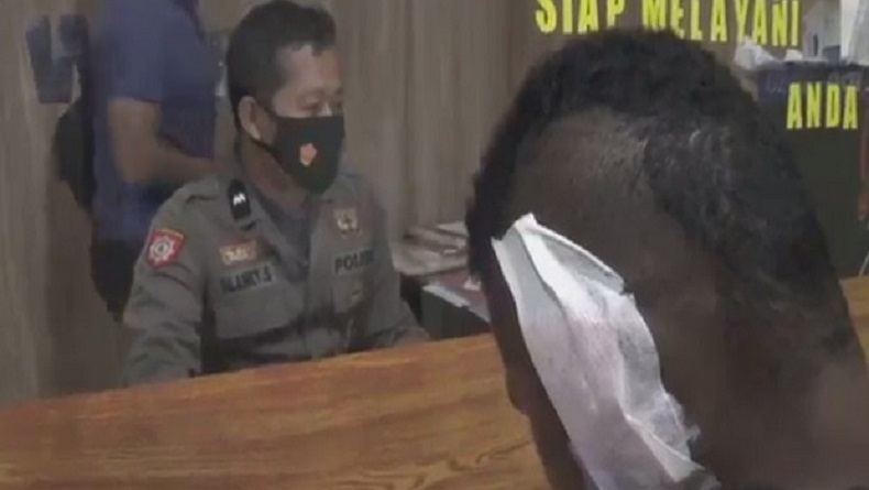 Duel Gegara Utang, Daun Telinga Pemuda Ini Digigit hingga Putus oleh WNA