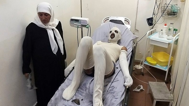 Tangki Bahan Bakar Meledak, 20 Orang Tewas dan 79 Luka-Luka