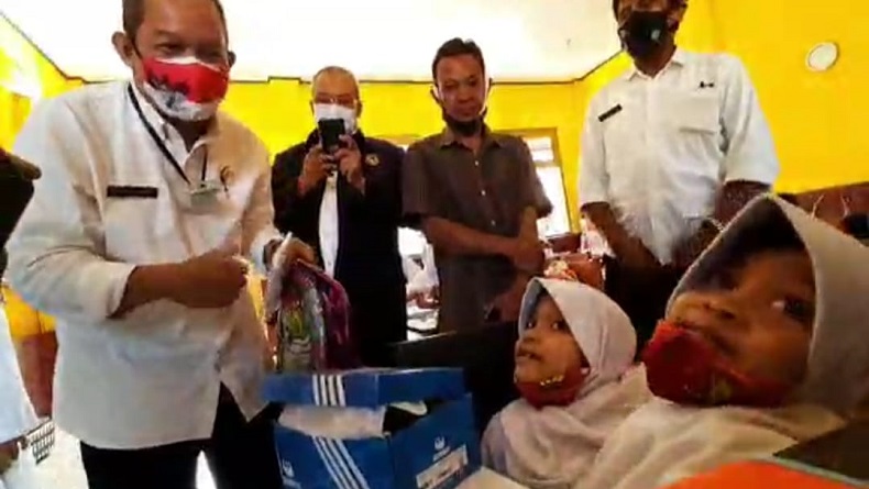 Kembar Siam Al Putri Dewi dan Al Putri Anugrah Tak Bisa Dipisah, Ini Penyebabnya