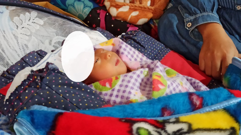 Bayi di Sukabumi Lahir Tanpa Tempurung Kepala, Butuh Uluran Tangan Dermawan