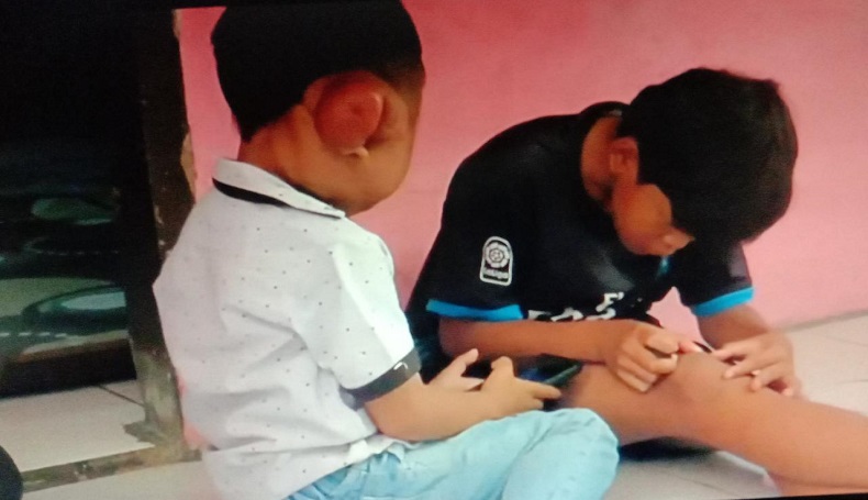 Idap Tumor sejak Lahir, Bocah di Sumedang Harus Kesakitan Bertahun-tahun