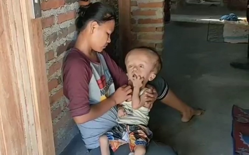 title Miris, Balita Indramayu Idap Hidrosefalus selama 5 Tahun, Orang Tua Kesulitan Biaya Berobat Miris, Balita Indramayu Idap Hidrosefalus selama 5 Tahun, Orang Tua Kesulitan Biaya Berobat