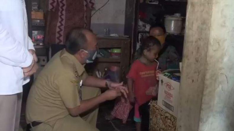 Diberi Susu dan Makanan, Begini Respons Balita Asal Tegal yang Gemar Makan Tanah 