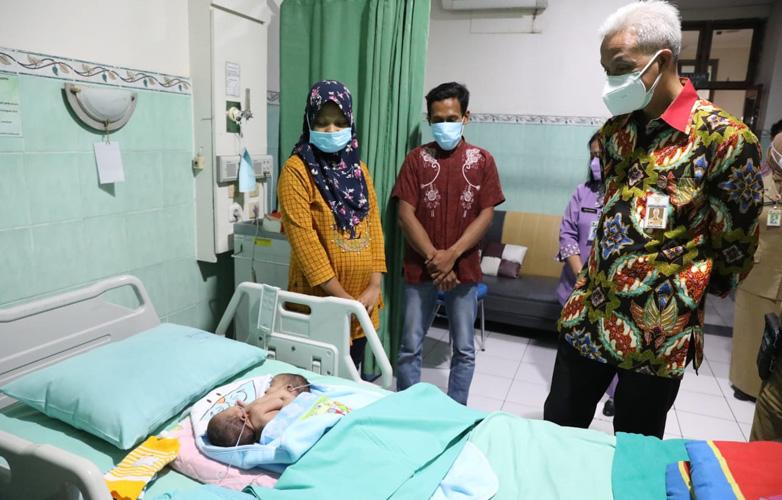 Momen Haru Ganjar Jenguk Bayi Kembar Siam Anak Buruh Bangunan di Solo