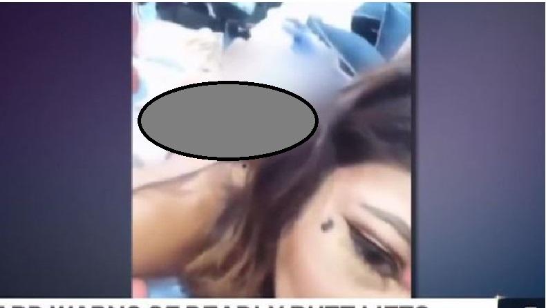 title Calon Bintang Porno Tewas Usai Bokongnya Disuntik Silikon Calon Bintang Porno Tewas Usai Bokongnya Disuntik Silikon