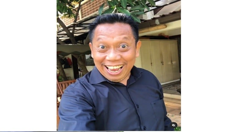 Tukul Arwana Pendarahan Otak, Kenali Gejalanya Berawal dari Nyeri Sekitar Mata