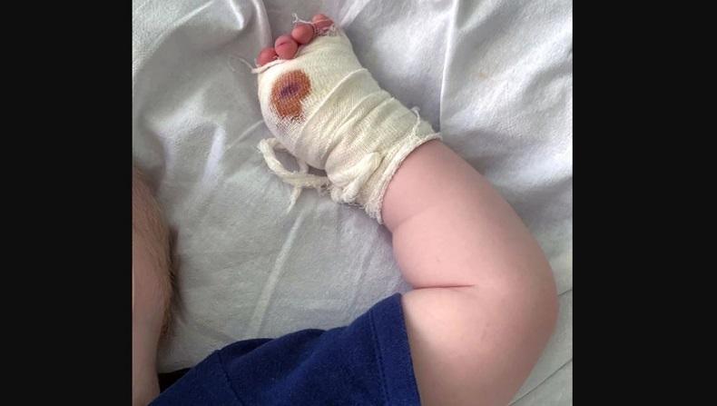 Mengerikan, Jempol Bocah 2 Tahun Digigit Harimau saat Kunjungi Taman Safari