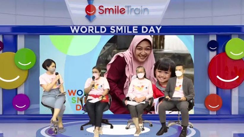 Senyum Pasien Bibir Sumbing Rayakan World Smile Day 2021 - Bagian 2