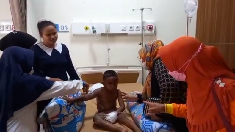 Pilu, Bocah 4 Tahun di Lampung Utara Tersiram Air Panas Rebusan Sang Ibu