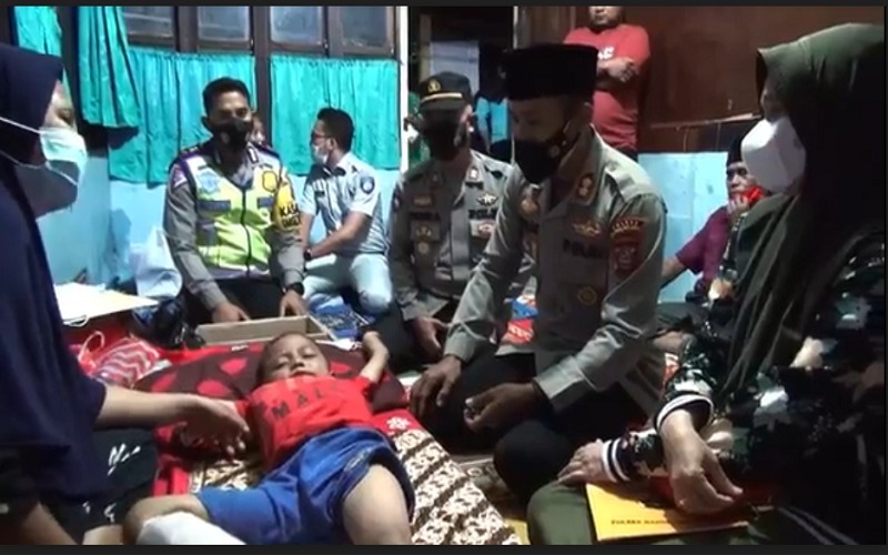 Dikejar Induk Ayam, Anak 6 Tahun Patah Kaki dan Trauma Tertabrak Pikap